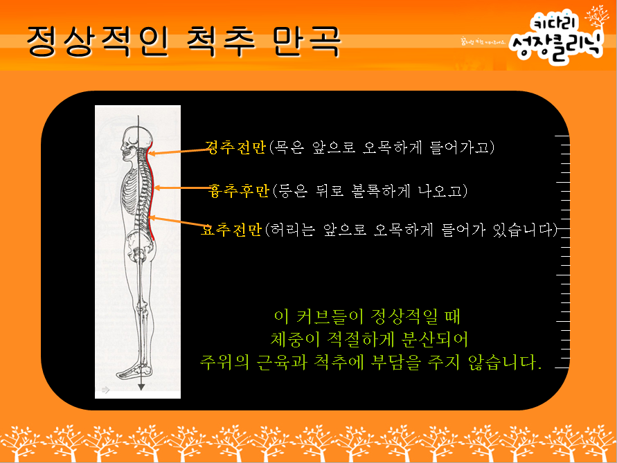 정상적인 척추 만곡