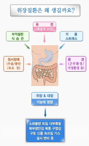 위장질환